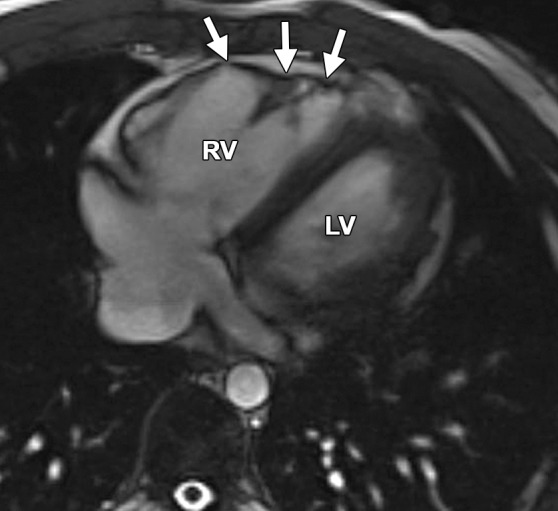 Figure 13d