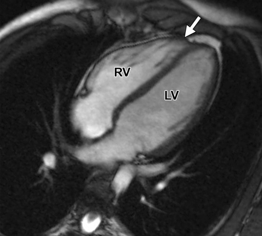 Figure 10a