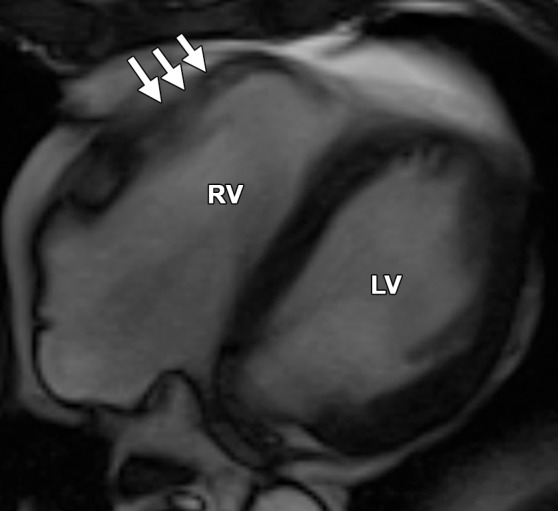 Figure 13a