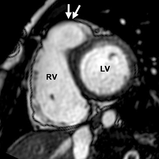 Figure 11c