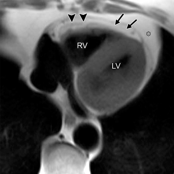 Figure 5a