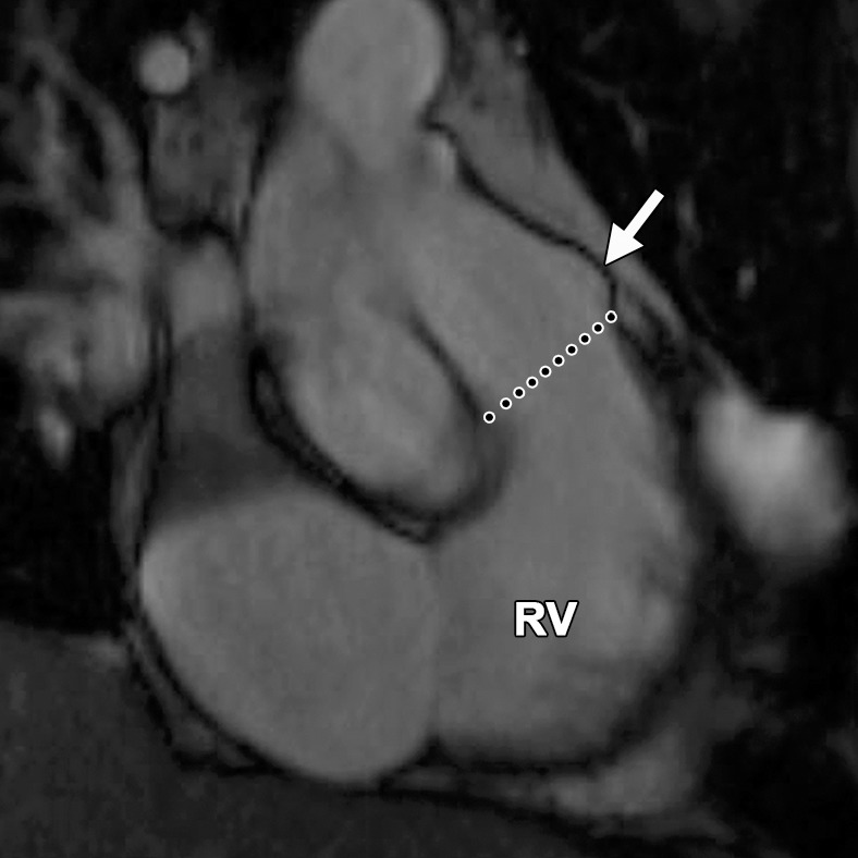 Figure 12b