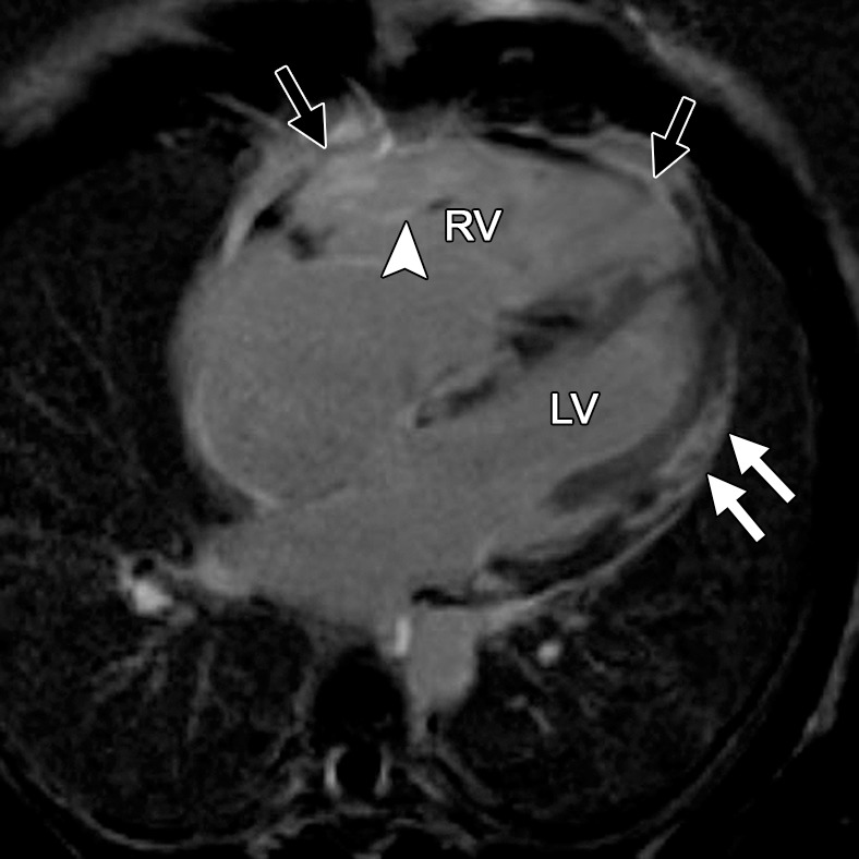 Figure 14a