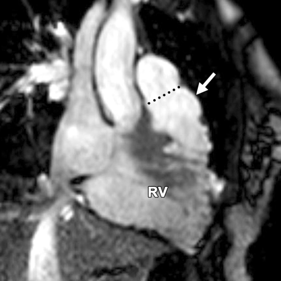 Figure 11b