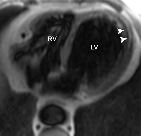 Figure 3b