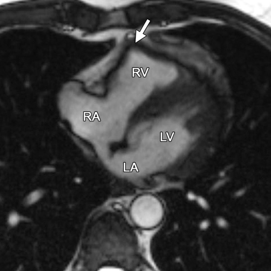 Figure 6b