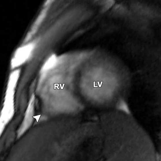 Figure 8c