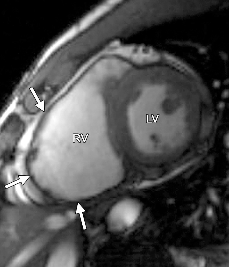 Figure 1b