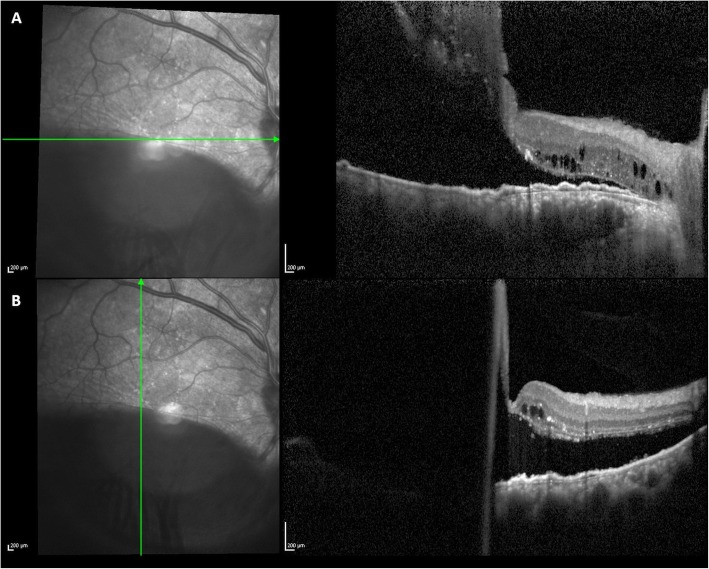 Fig. 4