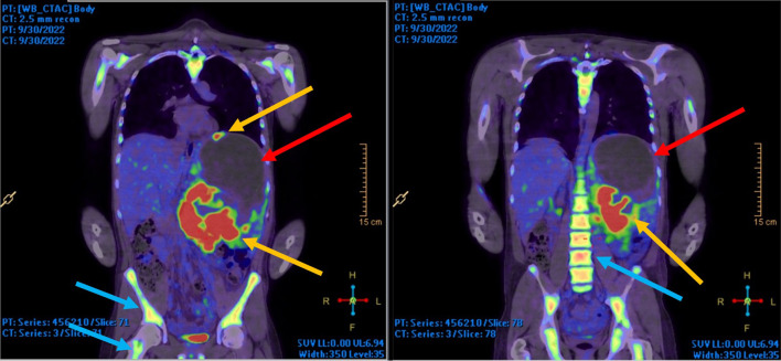 Fig. 2