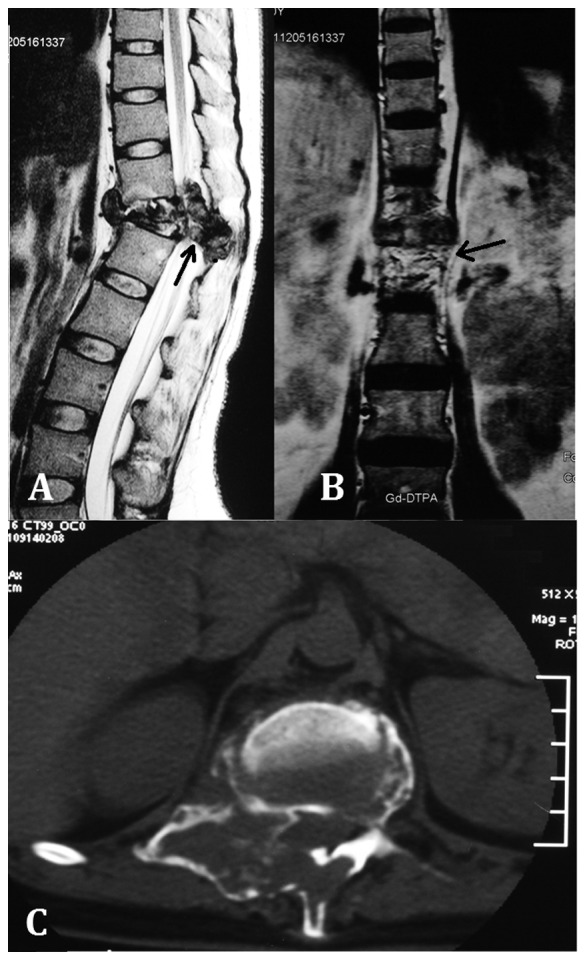 Figure 11