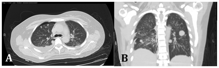 Figure 15