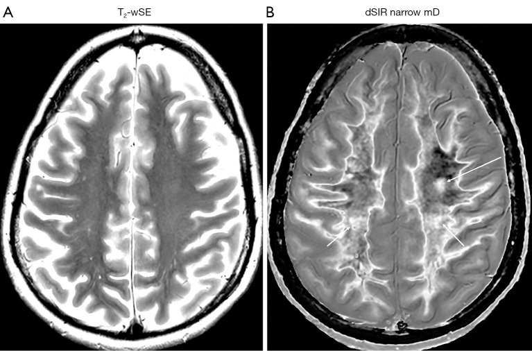 Figure 35