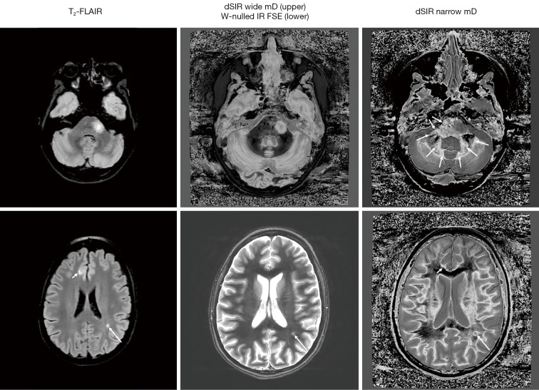 Figure 31