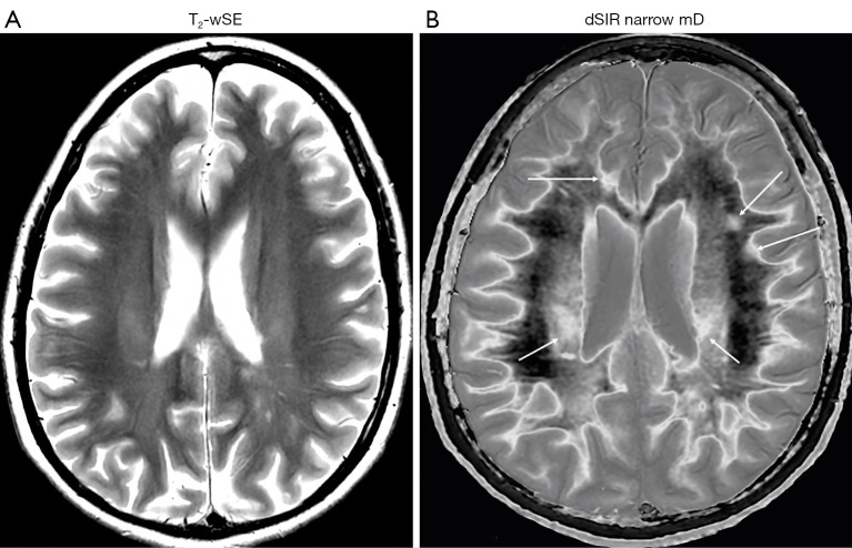 Figure 34