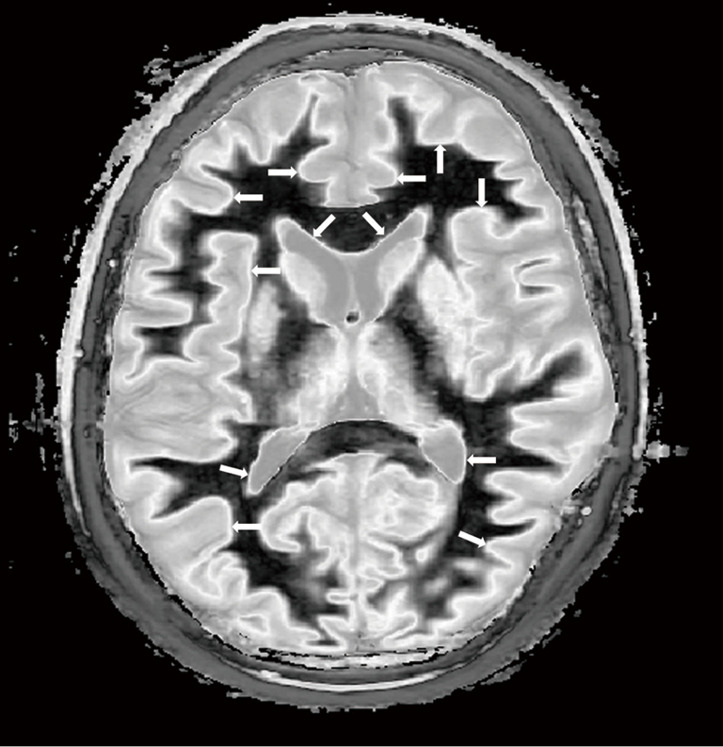 Figure 28