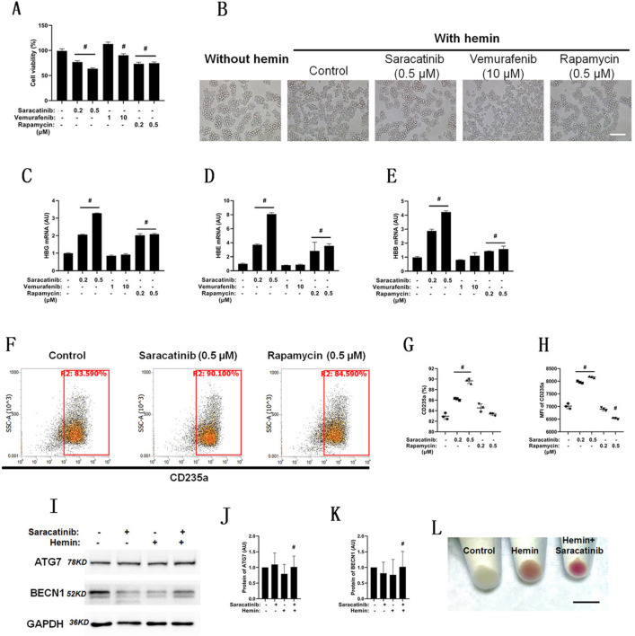 Saracatinib prompts hemin-induced K562 erythroid differentiation but ...