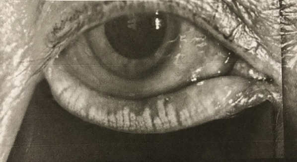 Fig. 3
