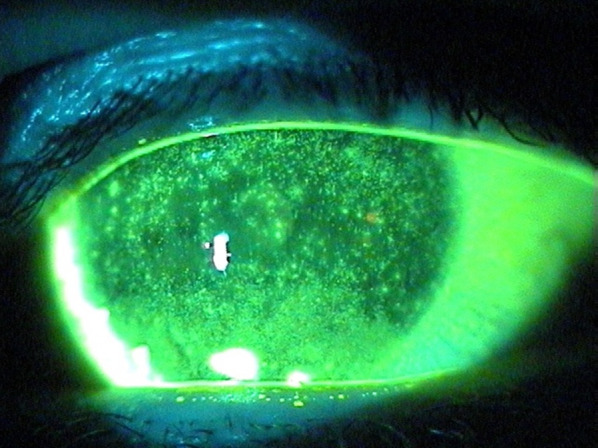 Fig. 4
