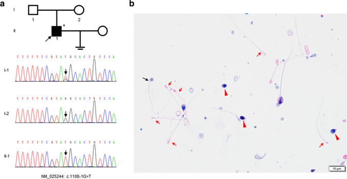 Fig. 1