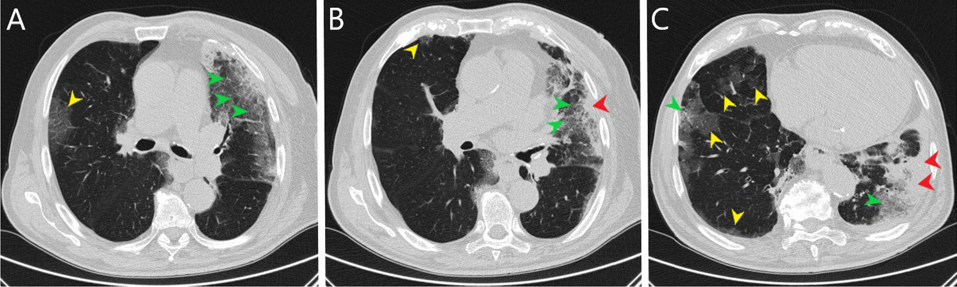 Fig. 2