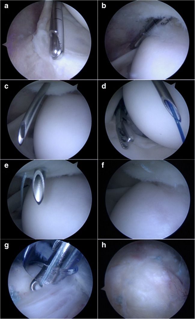 Fig. 6
