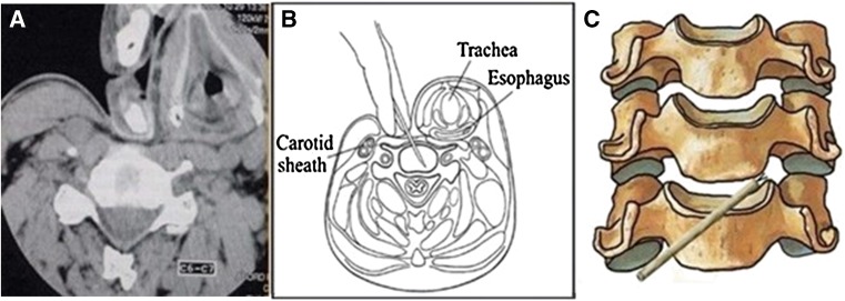 Fig. 2