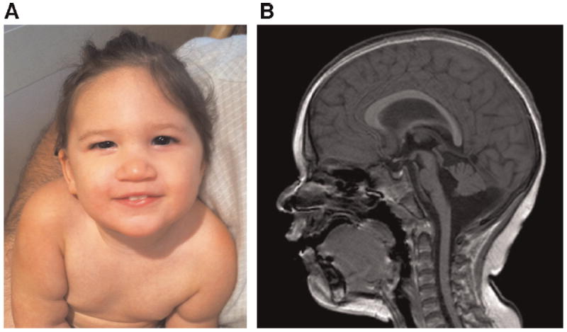 FIG. 1