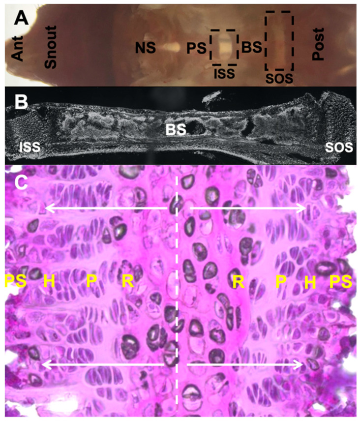 Cranial Base Synchondrosis: Chondrocytes at the Hub - PMC