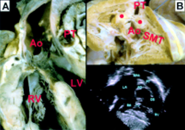 Figure 17  