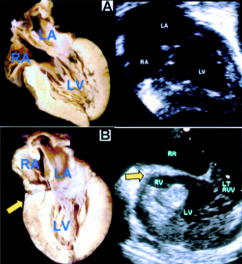 Figure 11  