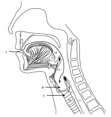 Fig. (2)