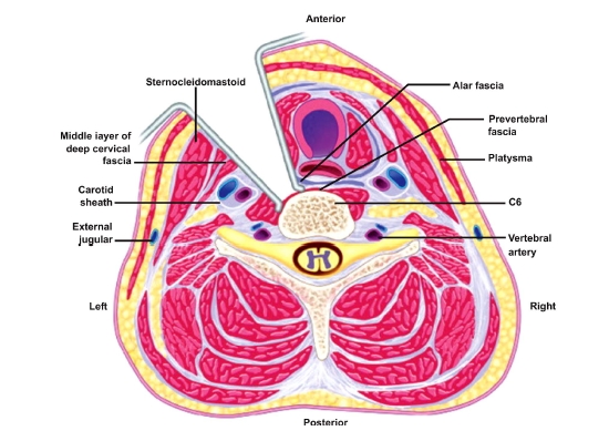 Fig. (3)