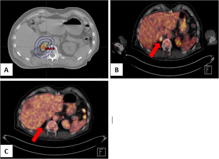 Fig. 2