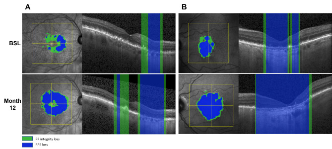 Fig. 3