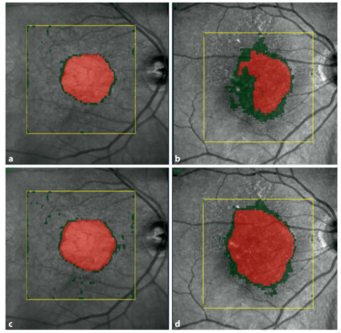 Fig. 4