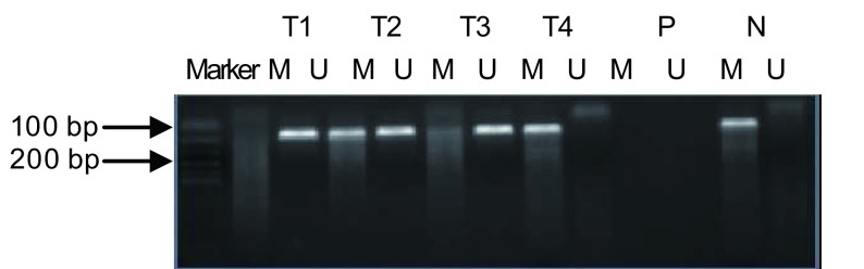 T1: begin lesion; T2: normal tissue; T3 and T4: lung cancer tissue; P: positive control; N: negative control; U, amplified product with primers recognizing the unmethylated sequences; M: amplified product with primers recognizing the methylated sequences. <break/>Hep-2 DNA methlated with Sss I methyltransferase as a positive control and distilled water was used as a negative control.