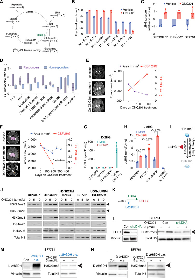Figure 5. ONC201 disrupts integrated metabolic and epigenetic pathways. A, Schema of [13C5]-glutamine tracing into the TCA cycle indicating predicted mass isotopes (m+4 or +5) for each metabolite. B, Bar graph demonstrating glutamine carbon incorporation in various metabolites (specific m+4 or +5 mass isotopes indicated) in H3.3K27M DIPG-007 cells treated with vehicle (blue) or 5 μmol/L ONC201 (red) for 48 hours (n = 3, each). C, Bar graph showing 2HG levels (Y-axis, Z-scores, measured by LC-MS) in H3.3K27M DIPGXIII*P, DIPG-007, and SF7761 cells treated with vehicle (blue) or 5 μmol/L ONC201 (red) for 48 hours (n = 3–4, each). D, Box and whisker plots showing metabolite measurements (Y-axis, ratio of metabolite pretreatment to posttreatment, a.u.) in CSF samples from ONC201-treated patients with H3K27M-DMG classified as responders and nonresponders (n = 4, each). Patients who showed a reduction in >50% tumor volume (per RANO criteria) on ONC201 were defined as responders. E, Tumor area (left Y-axis, purple line) and CSF 2HG levels (right Y-axis, red line) plotted against time (X-axis) from responder patient UMICH-006. F, Tumor area (left Y-axis, blue line) and CSF 2HG levels (right Y-axis, red line) plotted against time (X-axis) from nonresponder patient UMICH-022. Asterisks denote time points with metastatic disease. G, Bar plot showing D-2HG enantiomer-specific mass spectroscopy performed in H3.3K27M DIPG007, SF7761, and DIPGXIII*P cells treated with vehicle or ONC201 (5 μmol/L, 48 hours) and IDH1 R132H-mutant TB096 glioma cells. Quantification of D-2HG (μmol/mg protein, X-axis) is shown for ONC201-treated (brown) and DMSO-treated (green) cells. n = 4 for each condition. Data were analyzed using unpaired, two-sided, two-tailed, Student t test. H, Bar plot showing L-2HG enantiomer-specific mass spectroscopy performed in H3.3K27M DIPG007, SF7761, and DIPGXIII*P cells treated with vehicle or ONC201 (5 μmol/L, 48 hours) and IDH1 R132H-mutant TB096 glioma cells. Quantification of L-2HG (μmol/mg protein, X-axis) is shown for ONC201-treated (red) and DMSO-treated (blue) cells. n = 4 for each condition. Data were analyzed using an unpaired, two-sided, two-tailed, Student t test. I, Cartoon illustrating L-2HG inhibition of Jumonji C (JmjC) domain histone lysine demethylases resulting in increased histone methylation. J, H3.3K27M (DIPG007, DIPGXIII*P, H3.3K27M mNSC, and SF7761) and H3.1K27M (UON-JUMP4) cells were treated with 5 or 10 μmol/L ONC201 for 48 hours. Cells were probed for H3K27me3, H3K36me3, H3K9me3, H3K4me3, H3K27M, and total H3 (as loading control). The arrowhead indicates increased H3K27me3 and H3K36me3 across all cell lines. K, Cartoon illustrating L-2HG production from ±-KG by “promiscuous” activity of LDHA and L-2HG-specific dehydrogenase L-2HGDH converting L-2HG back to ±-KG. L, Left, H3.3K27M SF7761 cells transduced with or without shLDHA were probed for LDHA. Vinculin was used as a loading control. Right, SF7761 cells with or without LDHA knocked down were treated with vehicle or ONC201 (5 μmol/L, 48 hours) and probed for H3K27me3 and total H3 (as loading control). Arrowhead indicates H3K27me3. M, Left, L-2HGDH was overexpressed (o.e.) in H3.3K27M SF7761 cells. Cells were then probed for L-2HGDH. Vinculin was used as a loading control. Right, SF7761 cells with L-2HGDH overexpression were treated with vehicle or ONC201 (5 μmol/L, 48 hours) and probed for H3K27me3 and total H3 (as loading control). Arrowhead indicates H3K27me3. N, Left, D-2HGDH was overexpressed (o.e.) in H3.3K27M SF7761 cells. Cells were then probed for D-2HGDH. Vinculin was used as a loading control. Right, SF7761 cells with D-2HGDH overexpression were treated with vehicle or ONC201 (5 μmol/L, 48 hours) and probed for H3K27me3 and total H3 (as loading control). Arrowhead indicates H3K27me3.