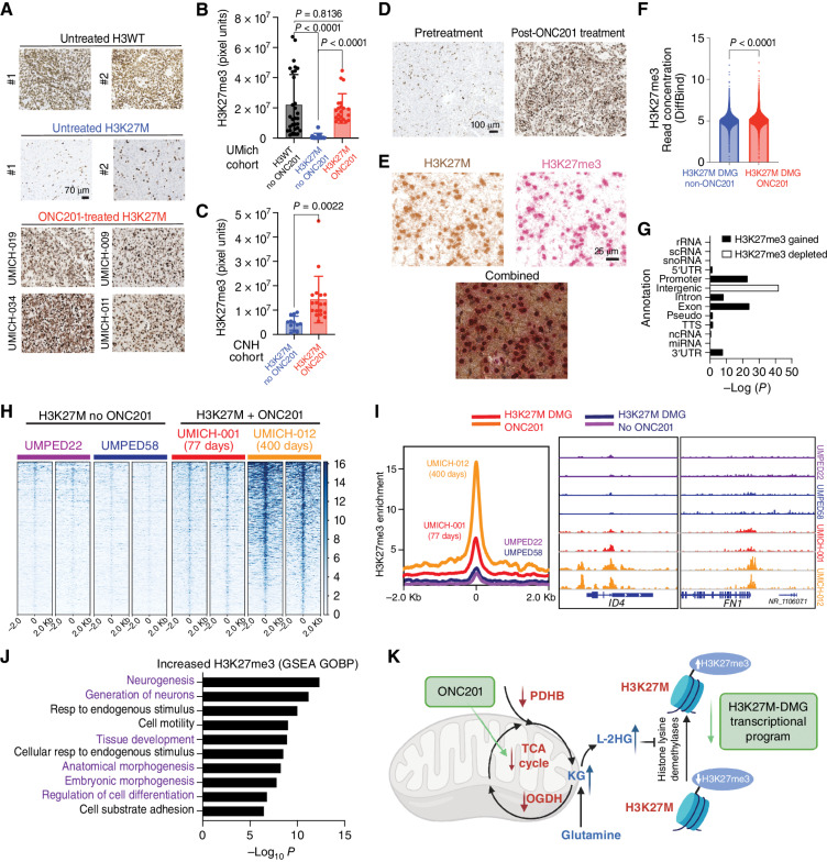 Figure 7. ONC201 treatment increases genomic H3K27me3 in H3K27M-DMG patient tumors. A, Representative images of tumor samples stained for H3K27me3 from untreated H3WT, untreated H3K27M-DMG, and ONC201-treated H3K27M-DMG patient tumor samples. B, Quantification of H3K27me3 (3 regions were captured in multiple tumor areas in a blinded manner/case) in H3WT non–ONC201-treated (n = 10, black), H3K27M non–ONC201-treated (n = 11, blue), or H3K27M ONC201-treated (n = 6, red) patient samples from the UMich Cohort. Data were analyzed using ANOVA. C, Quantification of H3K27me3 (3 regions were captured in multiple tumor areas in a blinded manner/case) in H3K27M non–ONC201-treated (n = 4, blue) or H3K27M ONC201-treated (n = 6, red) independent, nonoverlapping patient samples from the Children's National Hospital (CNH) Cohort. Data were analyzed using an unpaired, two-tailed, two-sided, nonparametric Mann–Whitney test. D, Representative images of H3K27M-DMG tumor samples from the UMich cohort stained for H3K27me3 from the same patient pretreatment (biopsy) or post-ONC201 treatment (autopsy). Data were analyzed using unpaired, two-tailed, two-sided, Student t test. E, Representative images from an ONC201-treated H3K27M-DMG tumor sample from the UMich Cohort stained with combined IHC for H3K27M (brown) and H3K27me3 (red). Images show brown or red chromogens or an overlay of both. F, Overall genome-wide H3K27me3 in ChIP-seq from H3K27M-DMG tumor samples treated with or without ONC201 treatment (n = 2 patients per condition). Data were analyzed using an unpaired, two-tailed, two-sided, nonparametric Mann–Whitney test. G, Comparison of genomic H3K27me3 in H3K27M-DMGs tumor samples derived from patients treated with (n = 2) or without (n = 2) ONC201 from F. H, Heat maps showing genomic H3K27me3 levels (± 2 Kb from peak center) in H3K27M-DMG tumor samples with (patients UMICH-001 and UMICH-012) or without (patients UMPED22 and UMPED58) ONC201 treatment. Each set of two heat maps represents replicates obtained from different tumor regions for each patient. I, Left, overall peak representation of genomic H3K27me3 in ONC201-treated (UMICH-001, orange; and UMICH-012, red) and non–ONC201-treated H3K27M-DMGs (UMPED22, purple; and UMPED58, blue). Right, representative H3K27me3 tracks for genes ID4 and FN1 from each tumor sample. J, GSEA of genes with significantly increased H3K27me3 in ONC201-treated versus untreated patients from F–I. K, Schema of the overall proposed mechanism of ONC201 impact on metabolic and epigenetic signaling in H3K27M-DMGs.