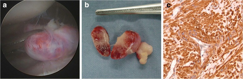 Fig. 2