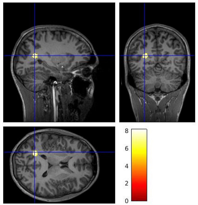 Figure 3.