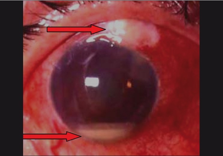 Figure 15