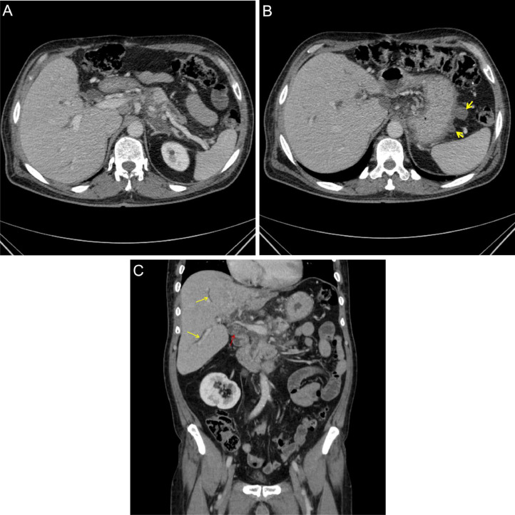 Fig 2 (
