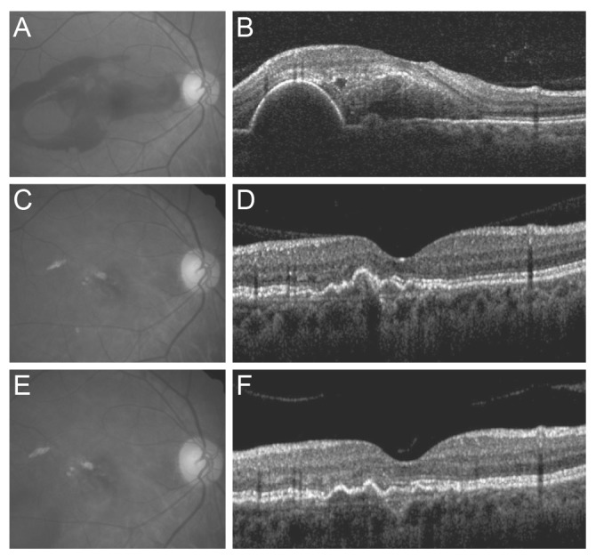 Fig. 1