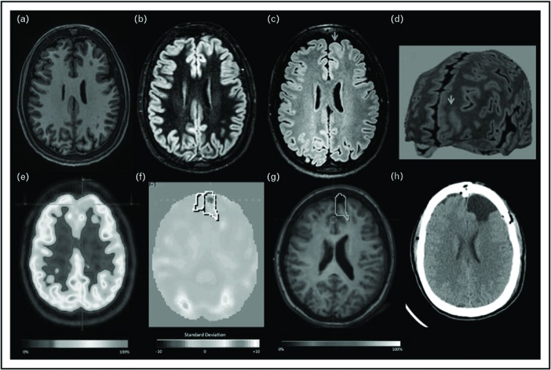 FIGURE 1