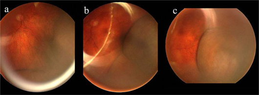 Fig. 1