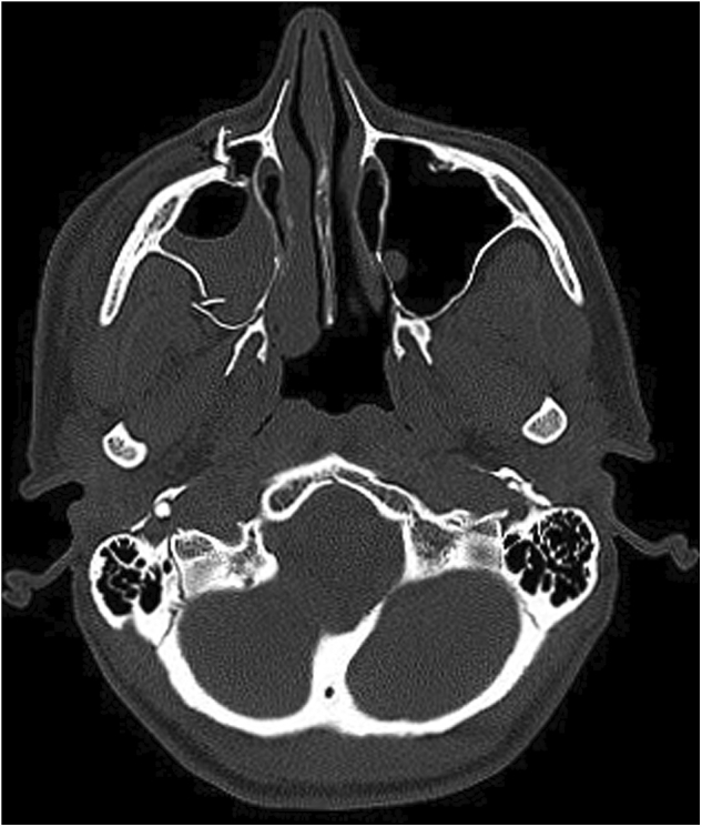 Fig. 2