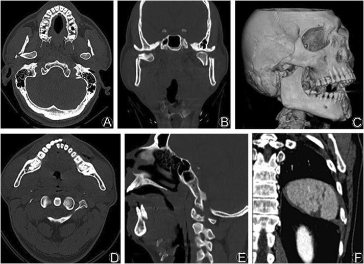 Fig. 1