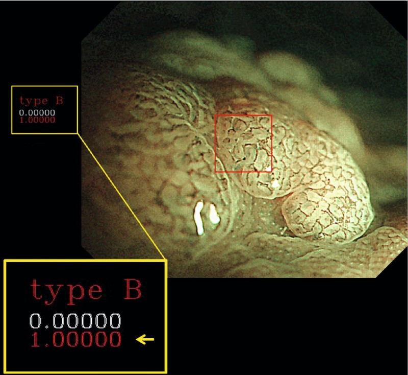 Fig. 2