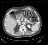 Fig. 2
